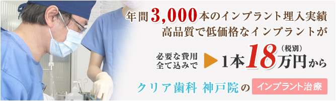 インプラント治療