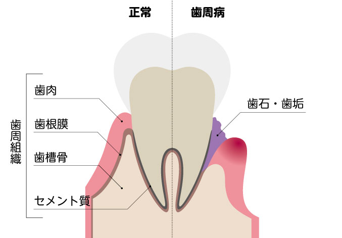 エムドゲイン法